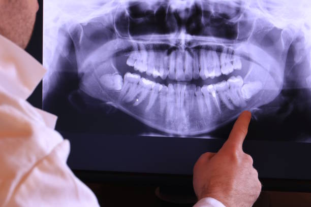 Best Cosmetic Emergency Dentistry in Jamestown, CA