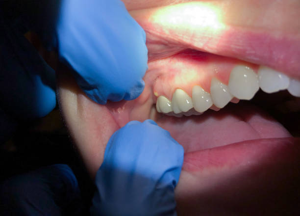 Best Emergency TMJ Treatment in Jamestown, CA