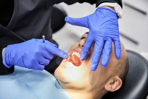 Best Emergency Tooth Extraction in Jamestown, CA